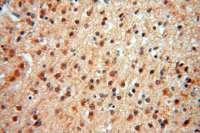 ATP6V1F Antibody in Immunohistochemistry (Paraffin) (IHC (P))