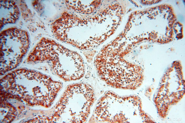 ATP6V1F Antibody in Immunohistochemistry (Paraffin) (IHC (P))