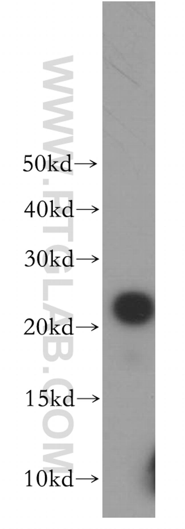 BLVRB Antibody in Western Blot (WB)