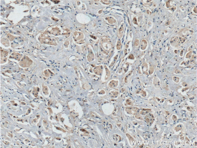 BCL10 Antibody in Immunohistochemistry (Paraffin) (IHC (P))