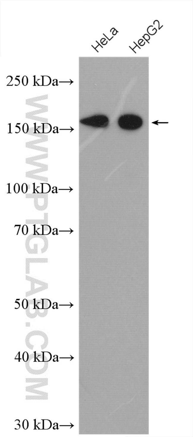 EDC4 Antibody in Western Blot (WB)