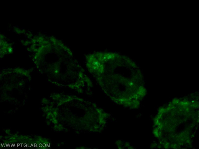 CPSF2 Antibody in Immunocytochemistry (ICC/IF)