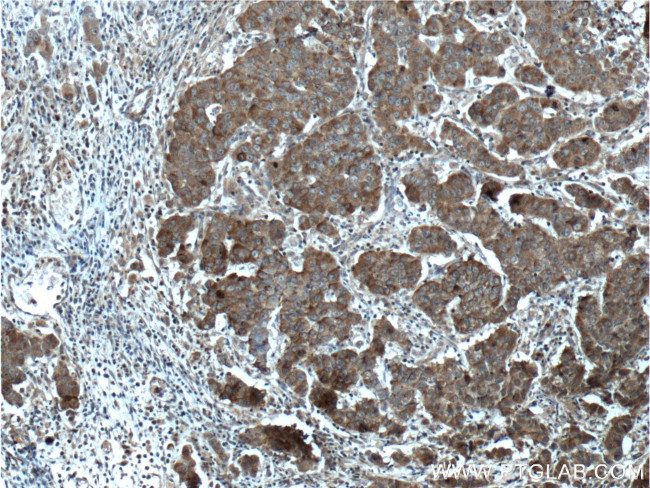 CNDP1 Antibody in Immunohistochemistry (Paraffin) (IHC (P))