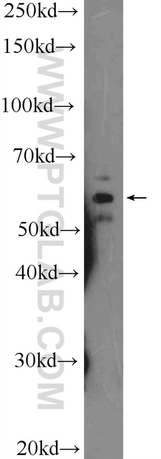 CNDP1 Antibody in Western Blot (WB)