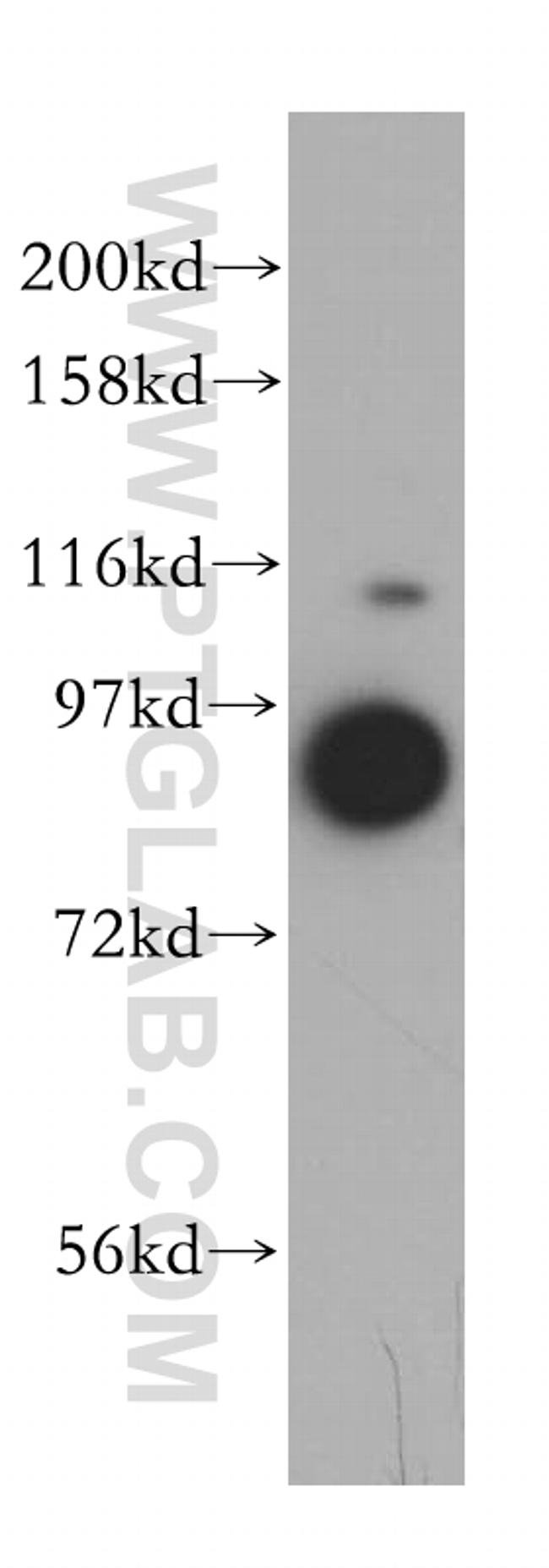 VPS16 Antibody in Western Blot (WB)