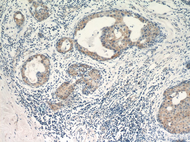 VCPIP1 Antibody in Immunohistochemistry (Paraffin) (IHC (P))