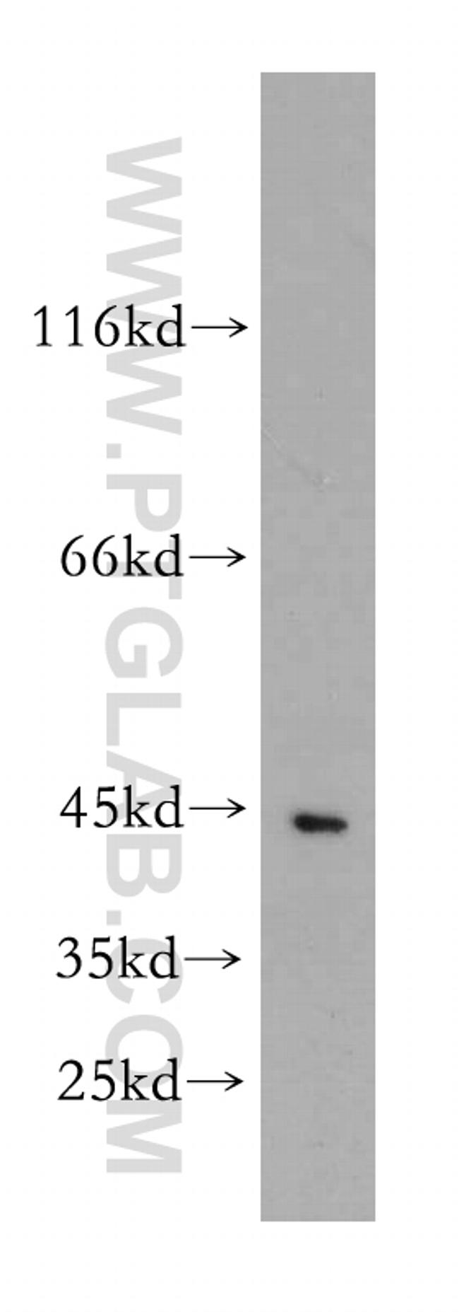 PGK1 Antibody in Western Blot (WB)