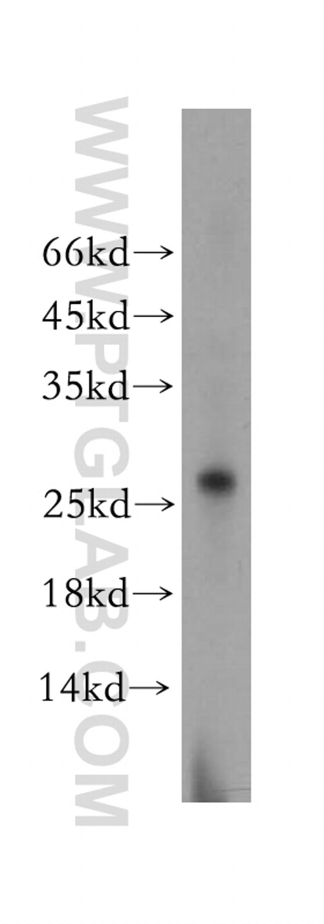 RABL2A Antibody in Western Blot (WB)