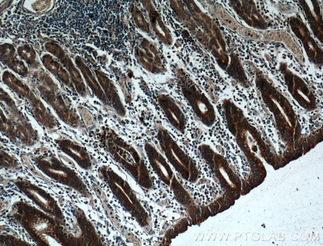 RAB27A Antibody in Immunohistochemistry (Paraffin) (IHC (P))