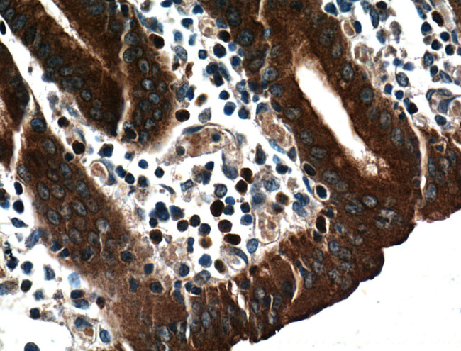 RAB27A Antibody in Immunohistochemistry (Paraffin) (IHC (P))