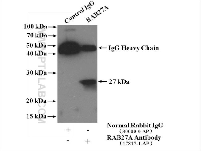 RAB27A Antibody in Immunoprecipitation (IP)