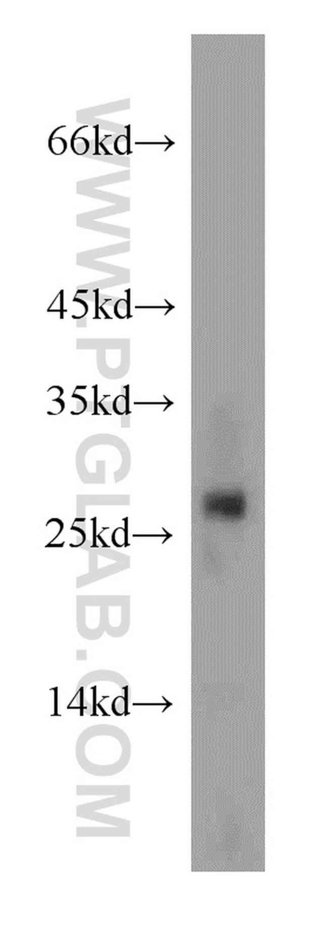 RAB27A Antibody in Western Blot (WB)