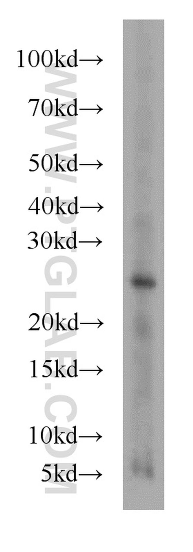 RAB27A Antibody in Western Blot (WB)