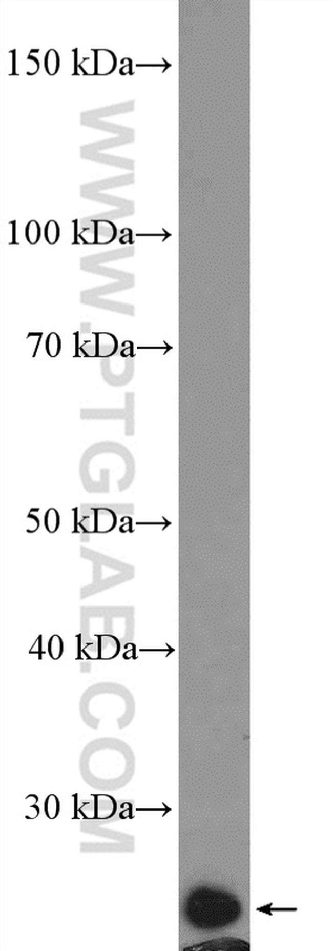 RAB27A Antibody in Western Blot (WB)