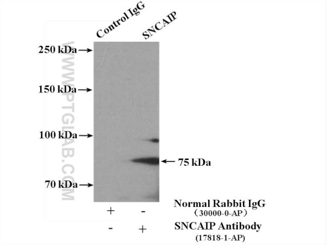 SNCAIP Antibody in Immunoprecipitation (IP)