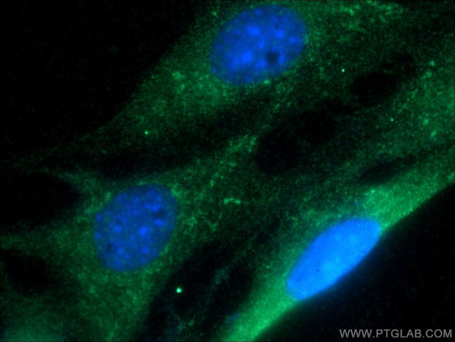 RAB1B Antibody in Immunocytochemistry (ICC/IF)