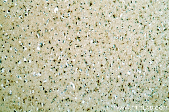 TCEA1 Antibody in Immunohistochemistry (Paraffin) (IHC (P))