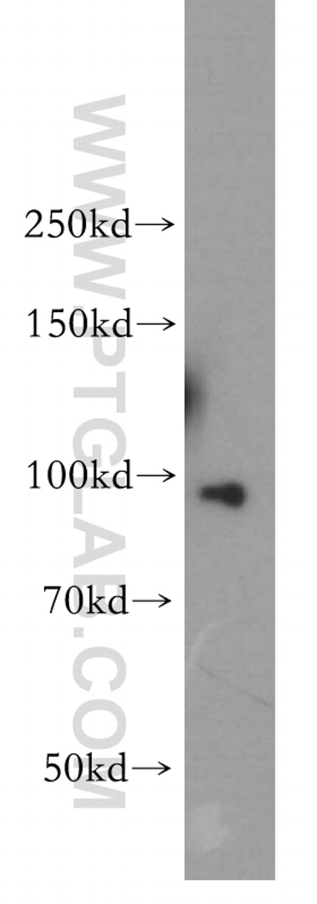 TNPO2 Antibody in Western Blot (WB)