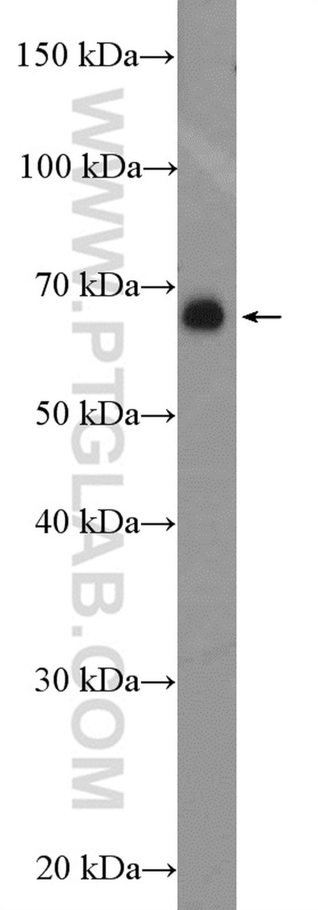 P2RX3 Antibody in Western Blot (WB)