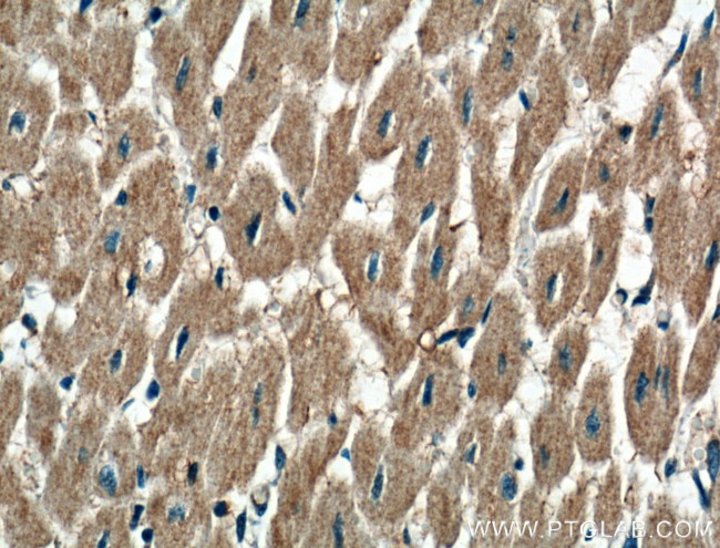 P2RX3 Antibody in Immunohistochemistry (Paraffin) (IHC (P))