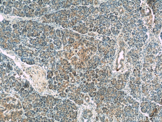 USP21 Antibody in Immunohistochemistry (Paraffin) (IHC (P))