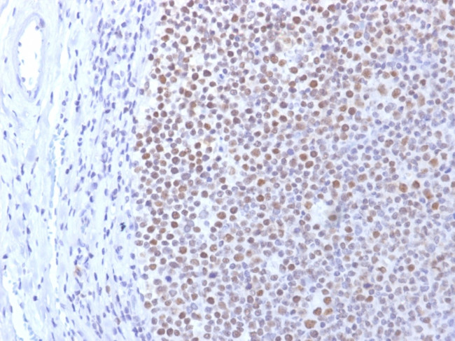 DNMT1/DNA Methyltransferase 1 Antibody in Immunohistochemistry (Paraffin) (IHC (P))