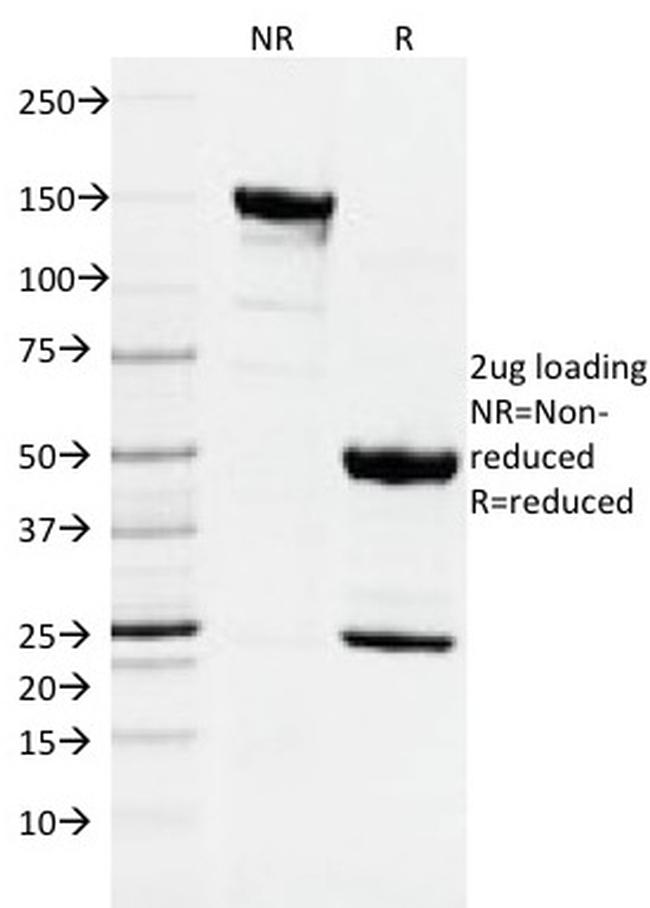 DNMT1/DNA Methyltransferase 1 Antibody in SDS-PAGE (SDS-PAGE)