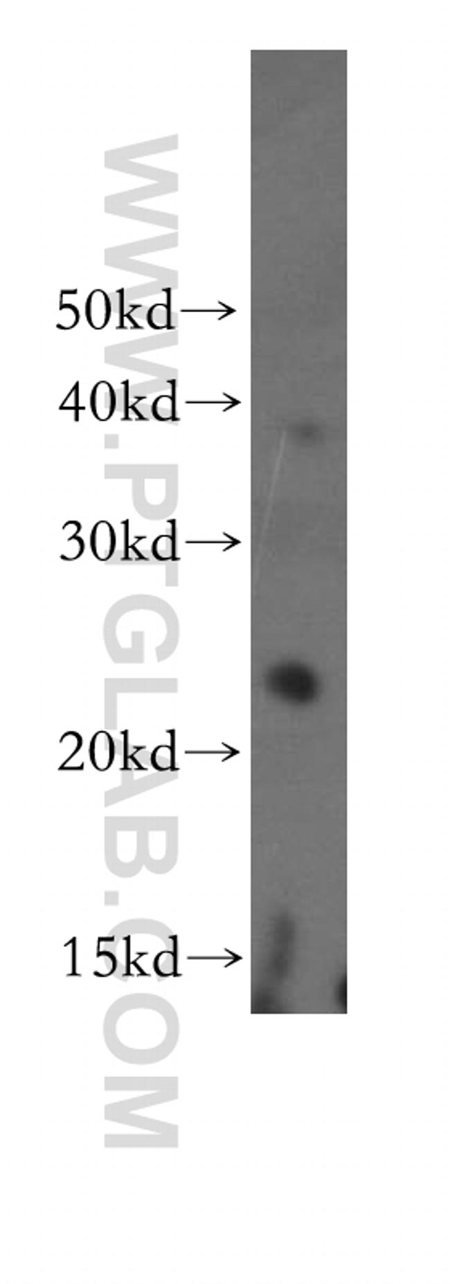 THOC7 Antibody in Western Blot (WB)