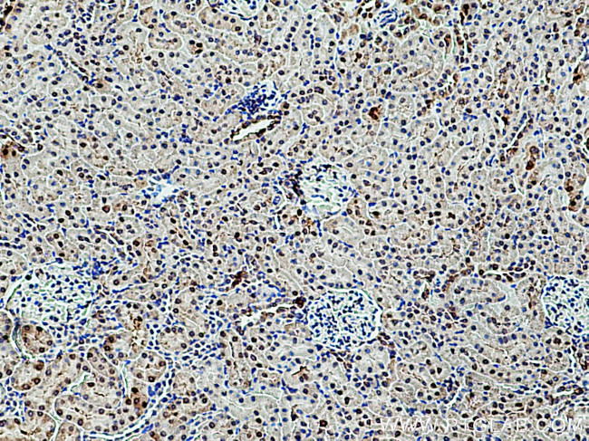 RGN/SMP30 Antibody in Immunohistochemistry (Paraffin) (IHC (P))