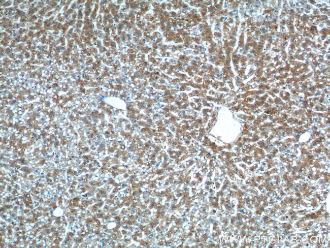 GPR177 Antibody in Immunohistochemistry (Paraffin) (IHC (P))