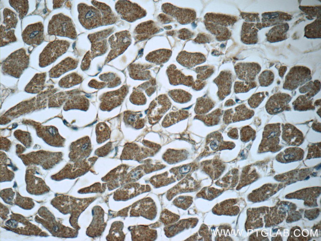 SRR Antibody in Immunohistochemistry (Paraffin) (IHC (P))