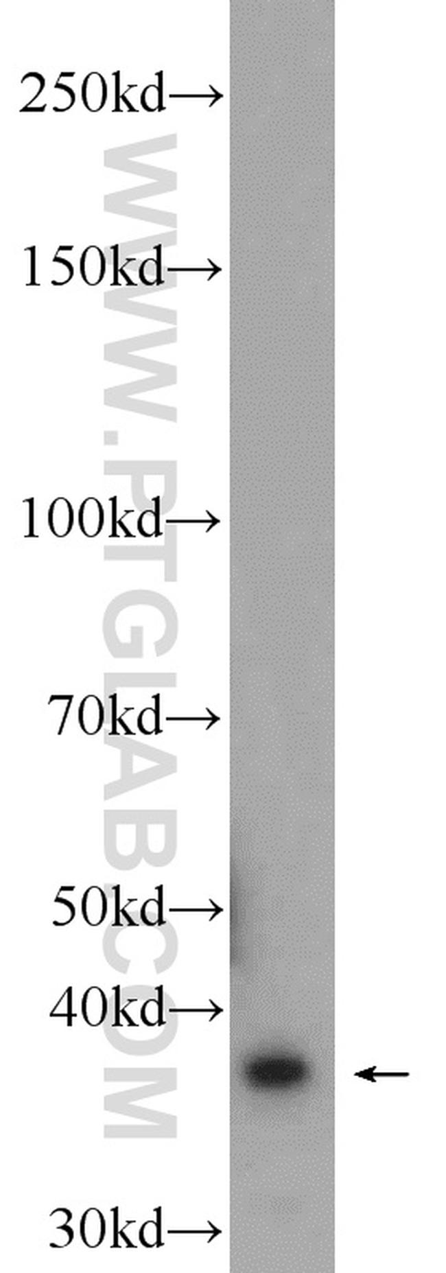 SRR Antibody in Western Blot (WB)