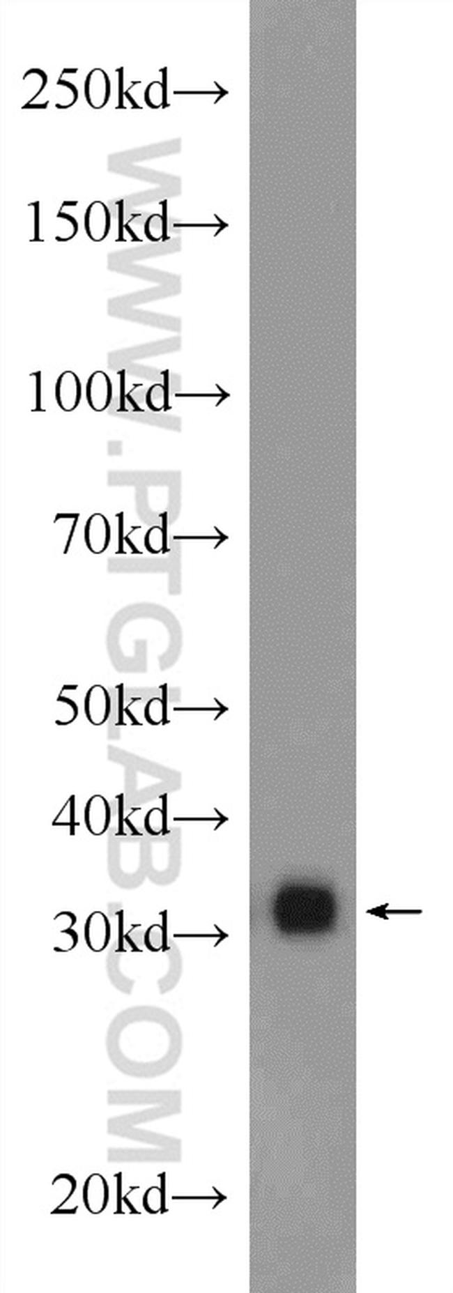 SRR Antibody in Western Blot (WB)