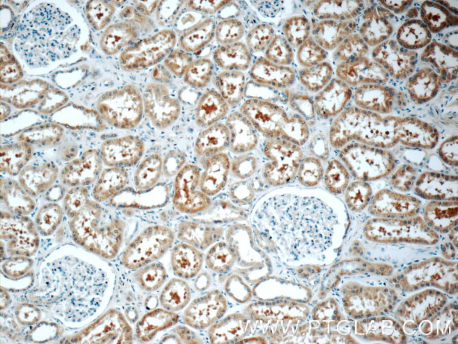 SRR Antibody in Immunohistochemistry (Paraffin) (IHC (P))