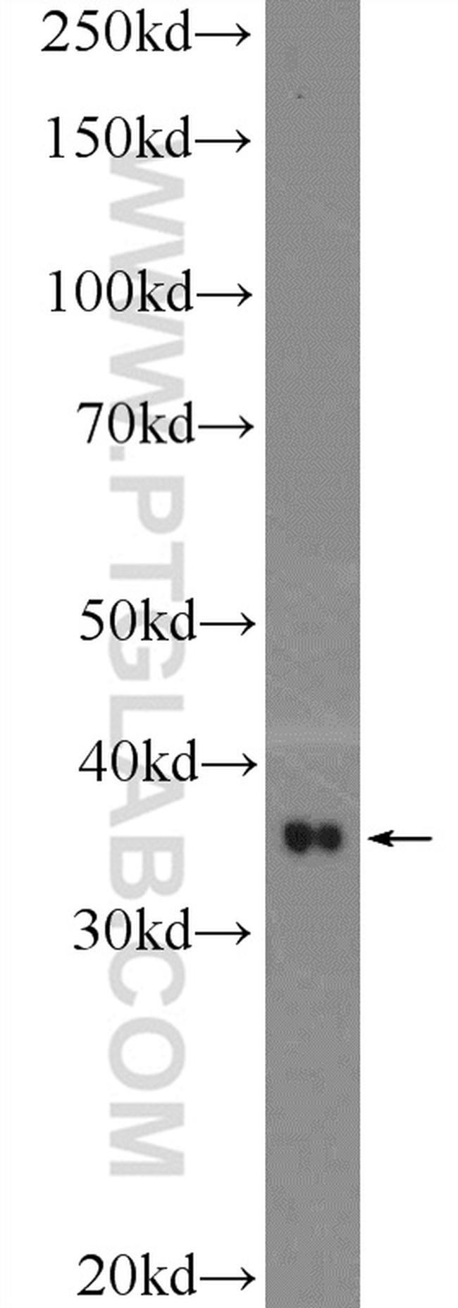 SRR Antibody in Western Blot (WB)