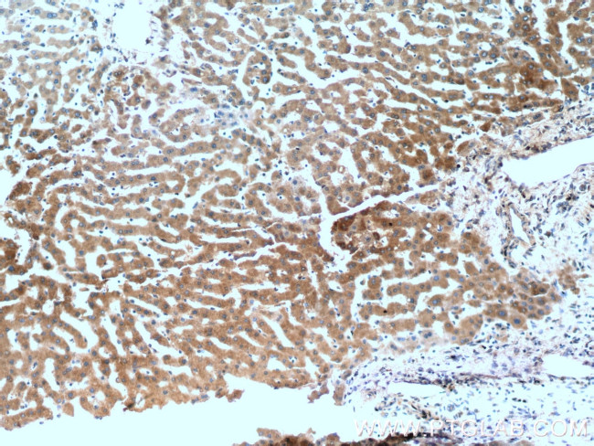 Acetylcholinesterase Antibody in Immunohistochemistry (Paraffin) (IHC (P))