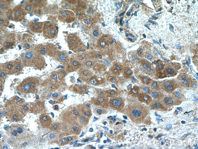 Acetylcholinesterase Antibody in Immunohistochemistry (Paraffin) (IHC (P))