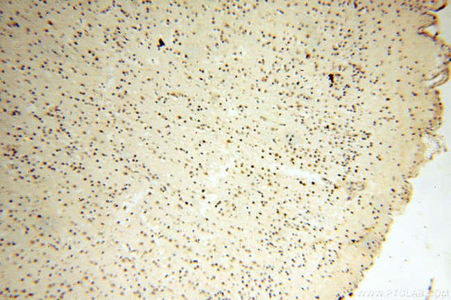 DNA polymerase beta Antibody in Immunohistochemistry (Paraffin) (IHC (P))