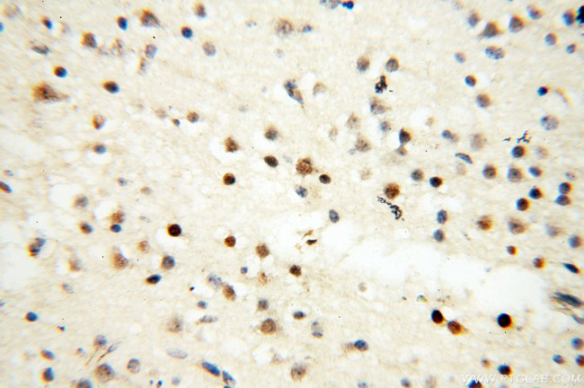 DNA polymerase beta Antibody in Immunohistochemistry (Paraffin) (IHC (P))