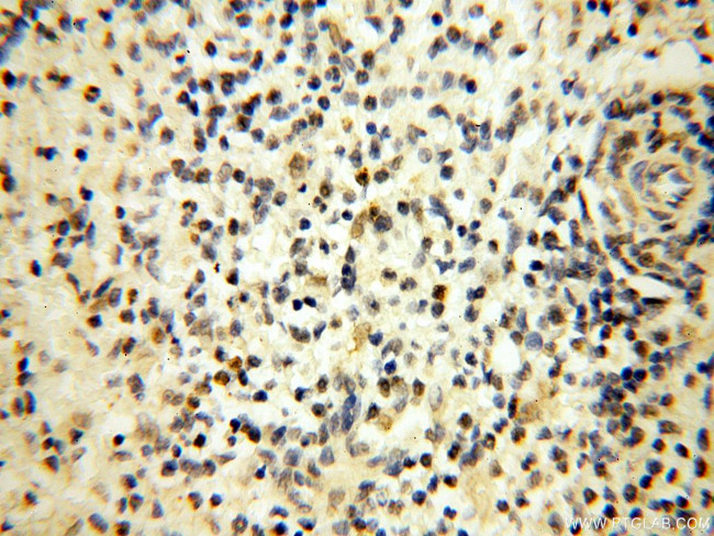 DNA polymerase beta Antibody in Immunohistochemistry (Paraffin) (IHC (P))