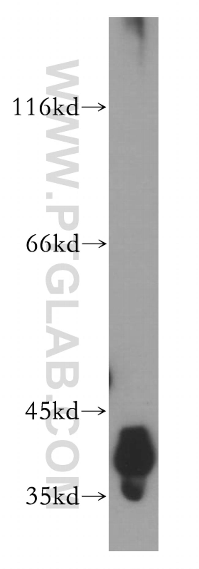 DNA polymerase beta Antibody in Western Blot (WB)