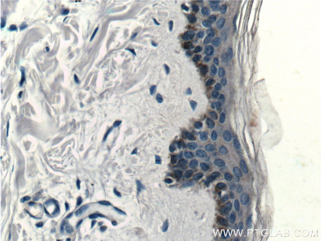 ST8SIA3 Antibody in Immunohistochemistry (Paraffin) (IHC (P))