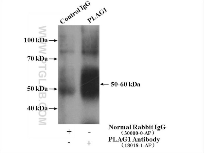 PLAG1 Antibody in Immunoprecipitation (IP)