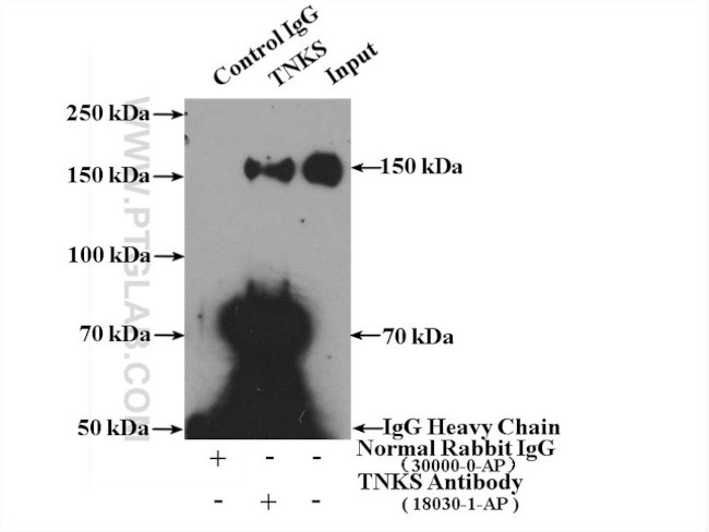 TNKS Antibody in Immunoprecipitation (IP)