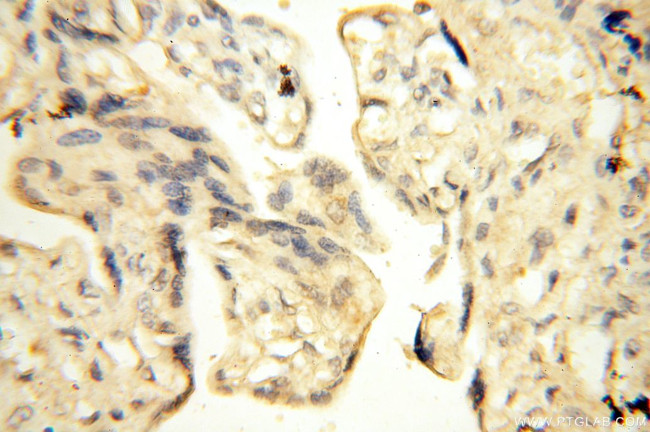 UBA52 Antibody in Immunohistochemistry (Paraffin) (IHC (P))