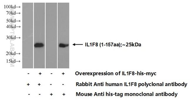 IL36 Beta/IL1F8 Antibody in Western Blot (WB)