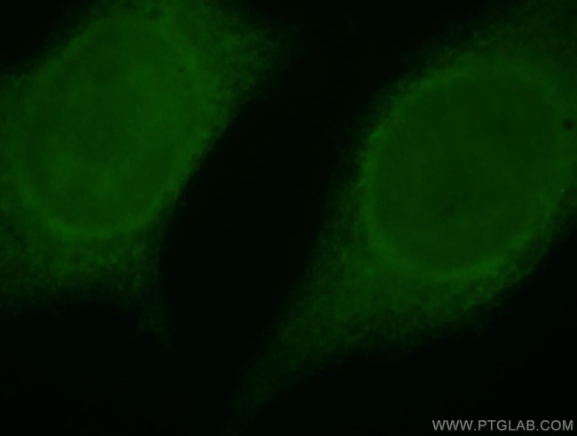 SERPINB13 Antibody in Immunocytochemistry (ICC/IF)