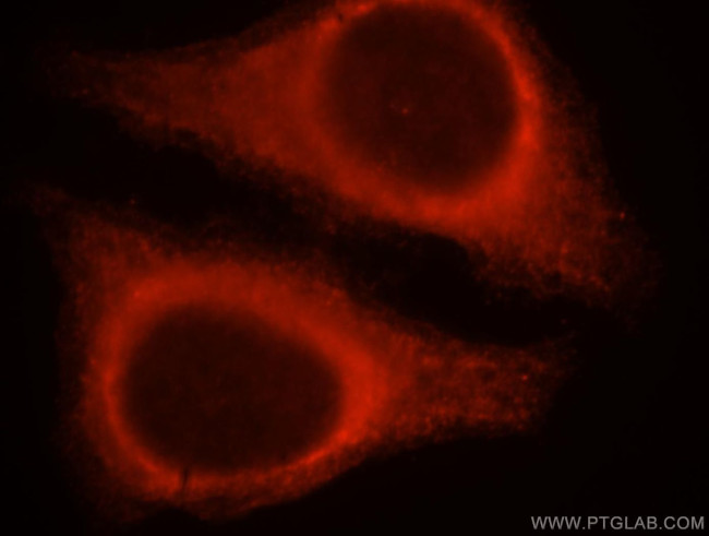 SERPINB13 Antibody in Immunocytochemistry (ICC/IF)