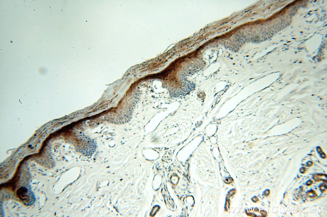 SERPINB13 Antibody in Immunohistochemistry (Paraffin) (IHC (P))