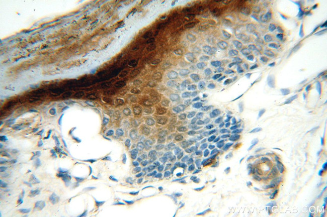 SERPINB13 Antibody in Immunohistochemistry (Paraffin) (IHC (P))